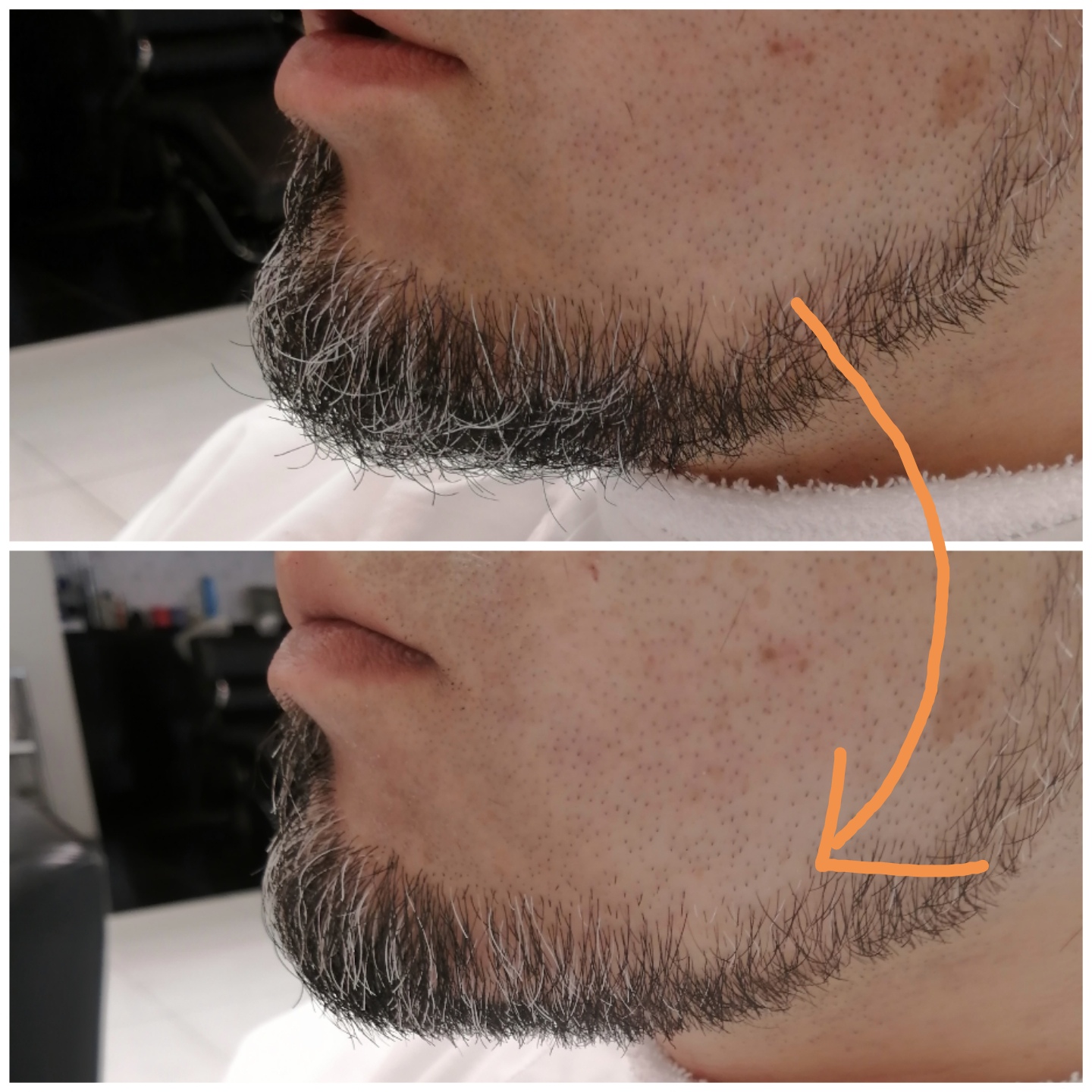 髭 を 生え にくく する 方法